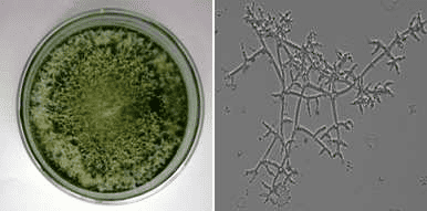 Trichodermae Viridae At Macro And Microscopic Examination